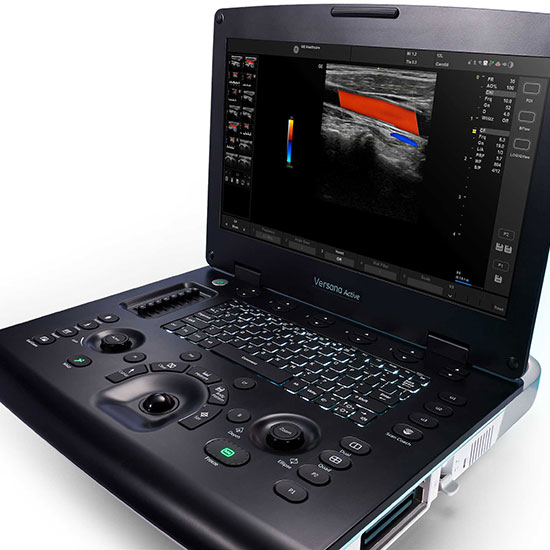 GE Logiq e portable ultrasound system